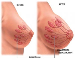 Breast Enhancement Cream result